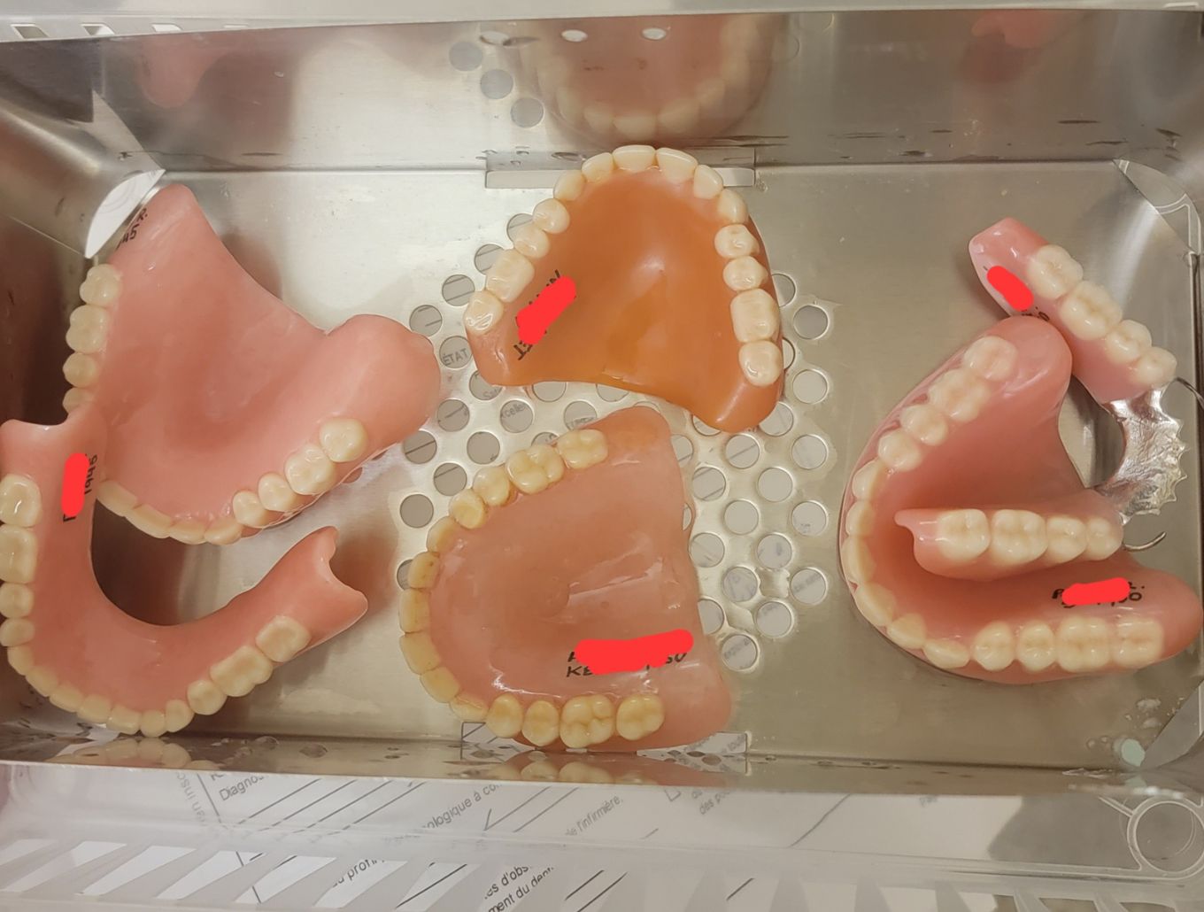 L'identification des prothèses dentaires